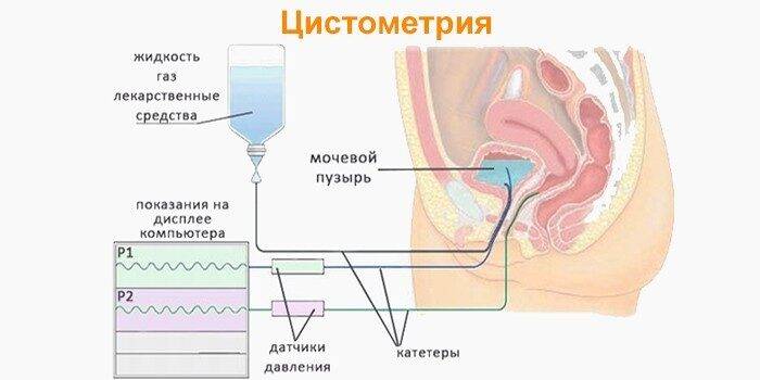 1546882056-tsistometriya