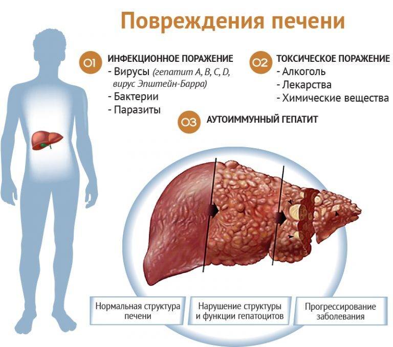 2-zabolevaniya_pecheni_simptomy_i_priznaki_bolezni-768x679-1