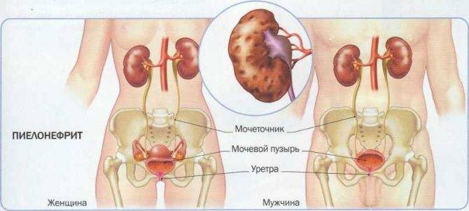 Антибиотики при пиелонефрите - наиболее эффективные лекарства