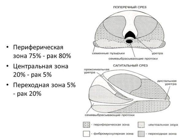 223-600x450-1