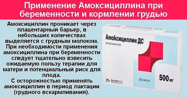 Амоксициллин при цистите у женщин: как принимать, дозировка, отзывы пациентов и врачей