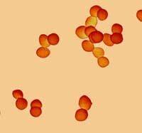 6f6fa-enterococcus-faecalis-u-muzhchin-simpto