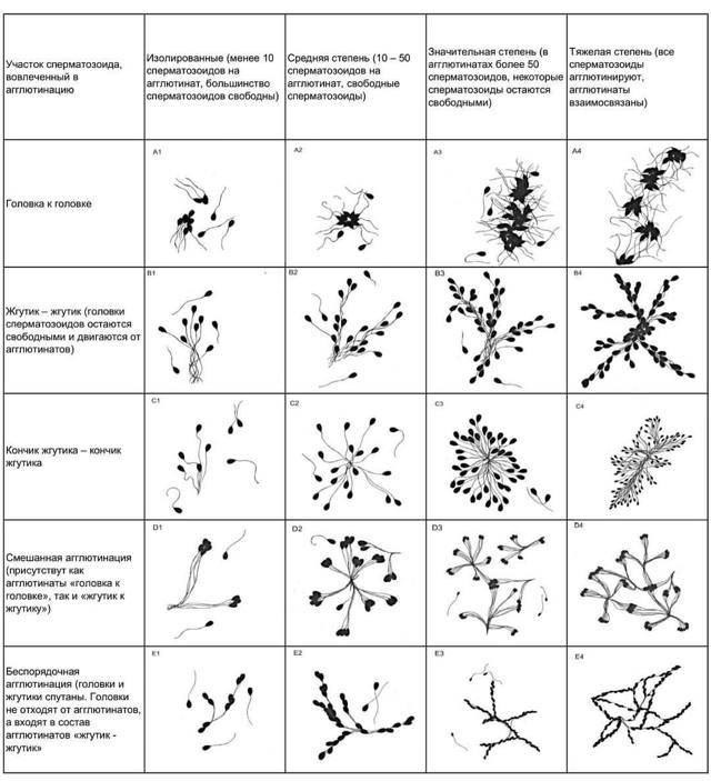 Агглютинация сперматозоидов: причины и лечение обнаруженной агглютинации