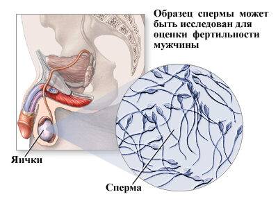 chto_delat_esli_ne_vydelyaetsya_sperma__lechenie_suschestvuet__1