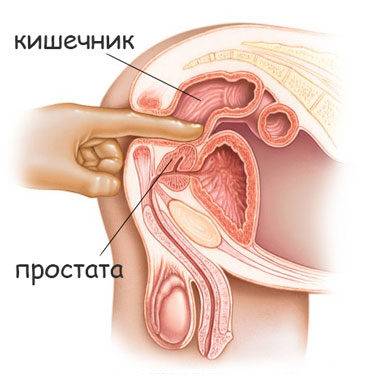 kalcinaty_v_predstatelnoy_zheleze_i_ih_udalenie_4