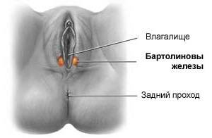 Больной с кистой бартолиниевой железы показано