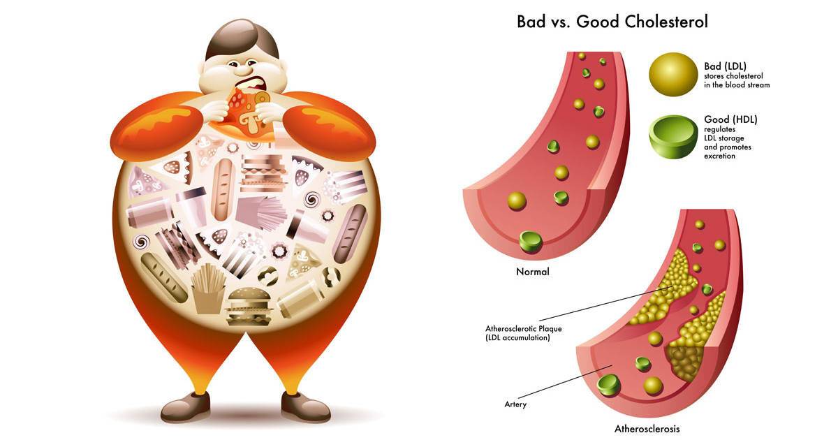 ldl-cholesterol-12