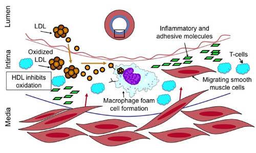 ldl-cholesterol-7