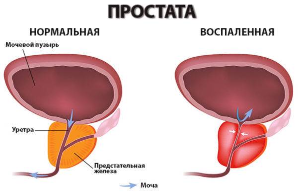 %d0%b8%d0%b7%d0%bc%d0%b5%d0%bd%d0%b5%d0%bd%d0%b8%d1%8f-%d0%bf%d1%80%d0%b8-%d0%bf%d1%80%d0%be%d1%81%d1%82%d0%b0%d1%82%d0%b8%d1%82%d0%b5-2