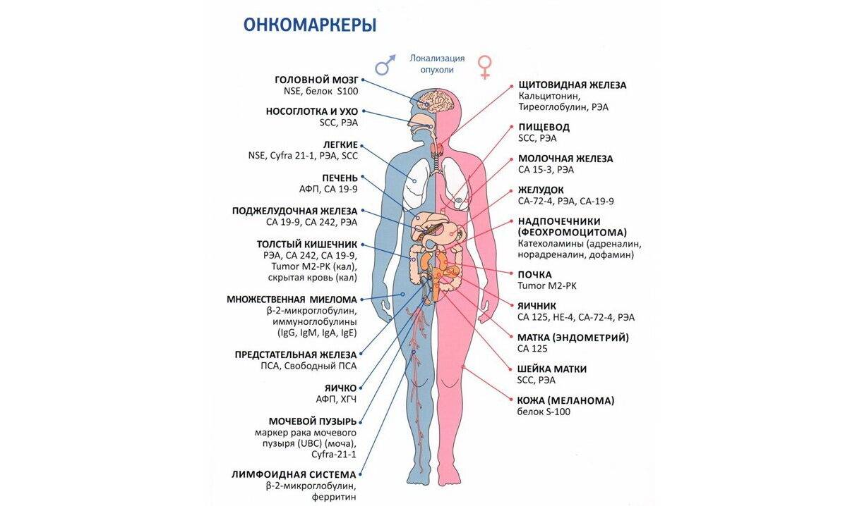 oblast-lokalizatsii-opuholi-po-vyyavlennym-onkomarkeram-istochnik-medik-expert