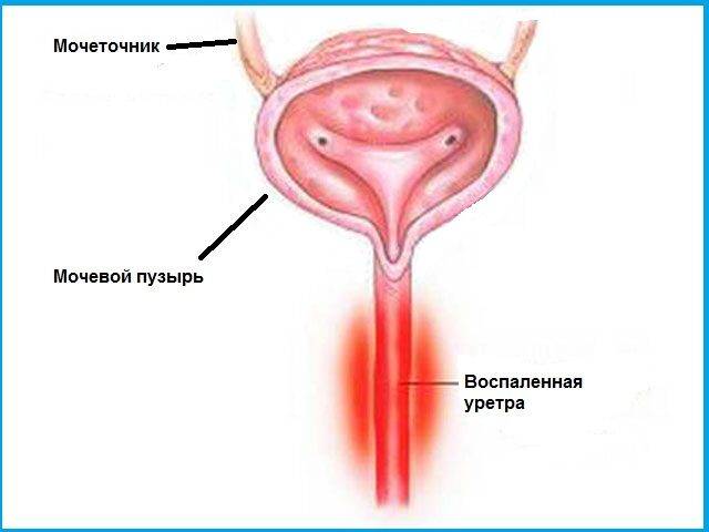 pochemu_poyavlyaetsya_diskomfort_pri_mocheispuskanii_u_muzhchin__2