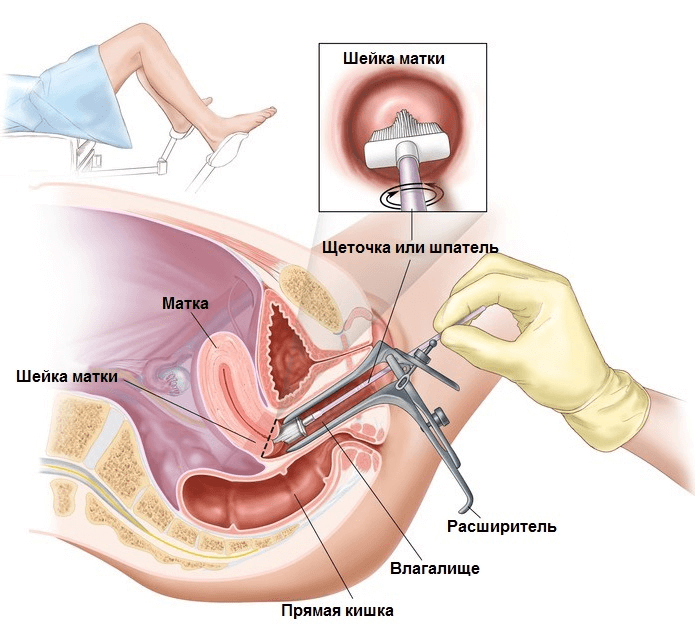 protsedura-zabora-biomateriala-dlya-opredeleniya-stepeni-chistoty-vlagalishha