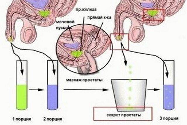 zabor-sekreta-prostaty