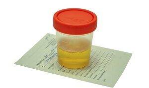 urine-sample-in-container-on-white-background