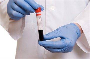 blood-test-tube-istk-dizzy_360x239-360x239-1