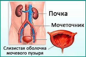 cistit-u-muzhchin-simptomy-3-1-300x200-1