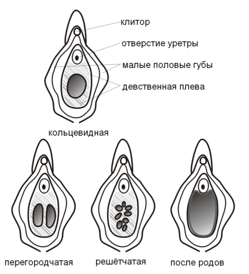 devstvennaya-pleva