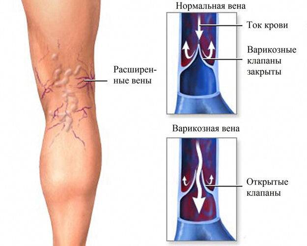 doplerograficheskoe-issledovanie-sosudov-2