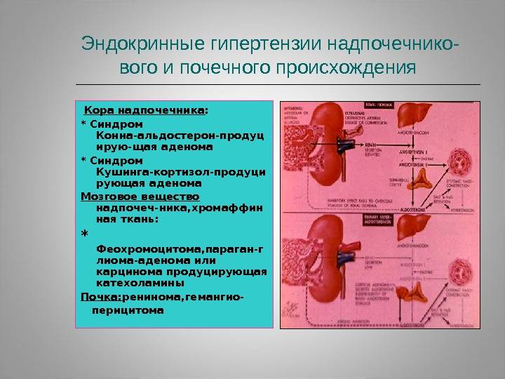 Норметанефрин и метанефрин в суточной моче