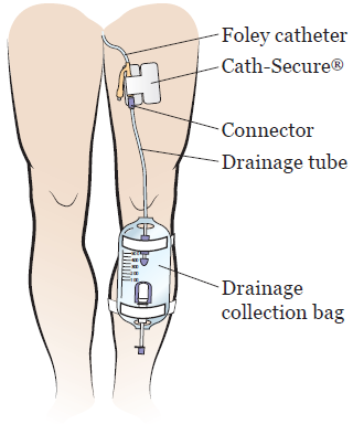 foley-fig_1-en