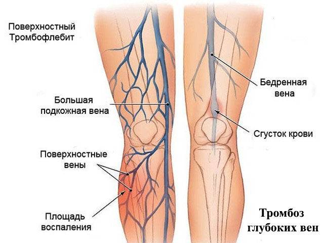 geparinovaya-maz-3