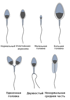 im224-335px-abnormalsperm-ru-svg_