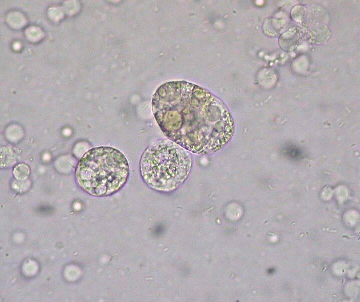 leukocytes-in-urine