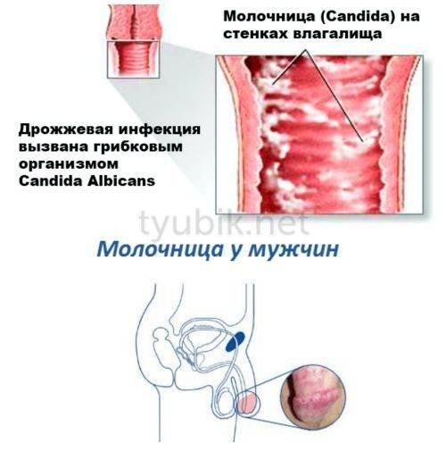 molochnica-u-muzhchin-i-zhenshchin