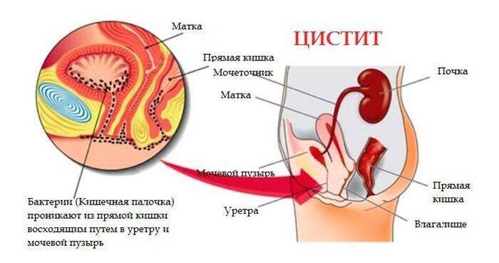 nastoyka-bobrovoy-strui-2-e1561665593379