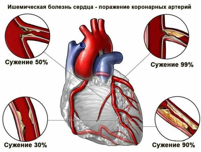 nastoyka-bobrovoy-strui-3