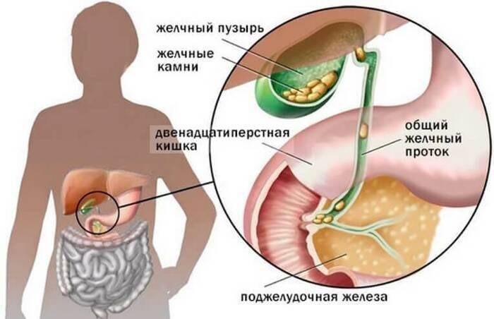 nastoyka-bobrovoy-strui-4