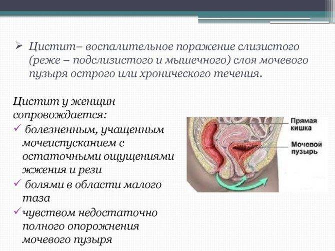 ne-prohodyat-simptomi-tsistita