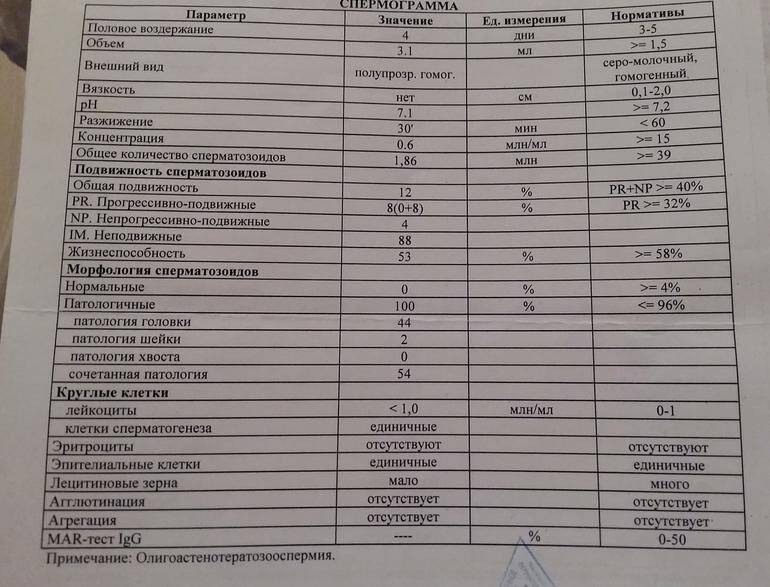 oligoastenoteratozoospermiya-v-spermogramme