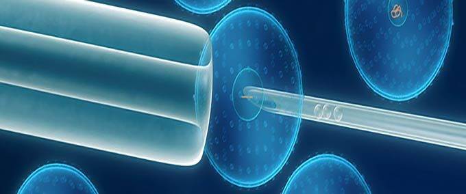 otsutstvie-spermatozoidov-1