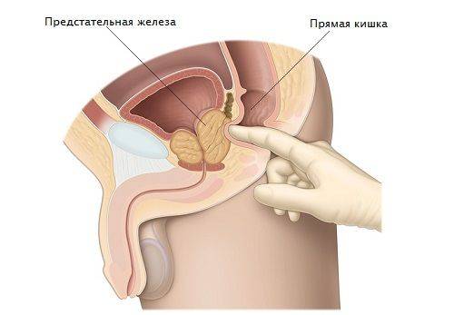 пальпация предстательной железы