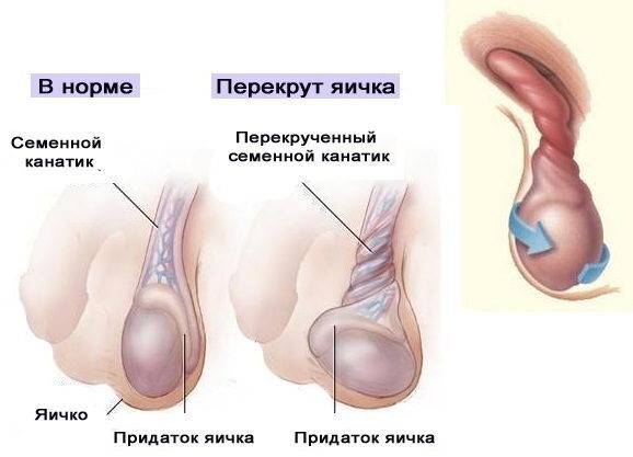 perekrut-yaichka2-2