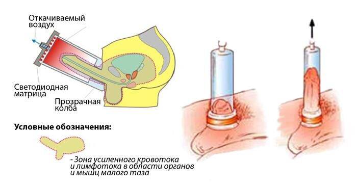 provedeniya-seansov-lod-terapii