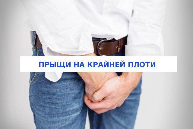 man-covering-his-crotch-with-both-hands-shutterstock-id-257216062