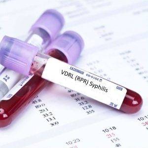 rpr-syphilis-tests-1-300x300-1