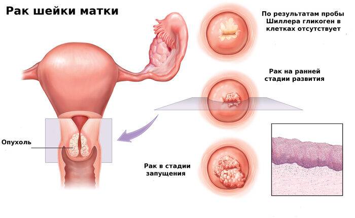 sheyka-matki-foto-10