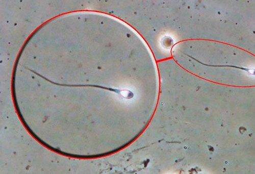 spermatozoid2