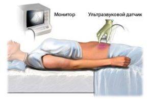 transabdominalnoe-uzi2-300x196-1