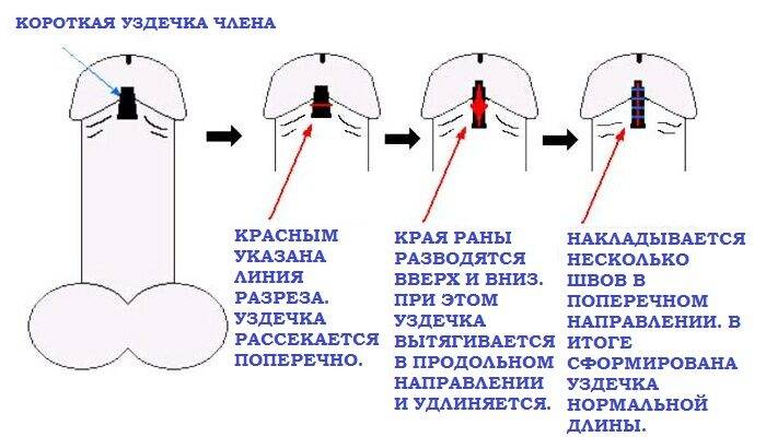 uzd_chl_5