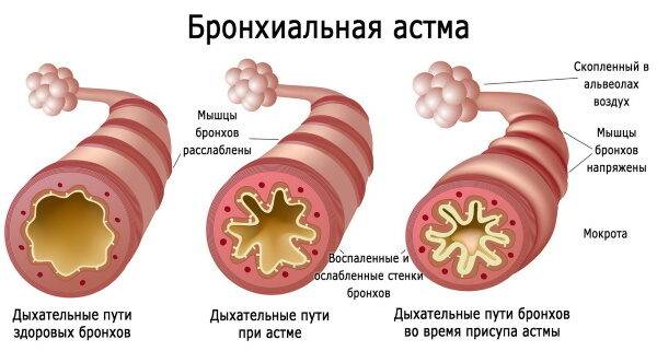 vinilin-balzam-shostakovskogo-3