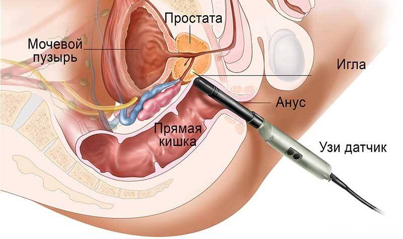 vzyatie-biopsii