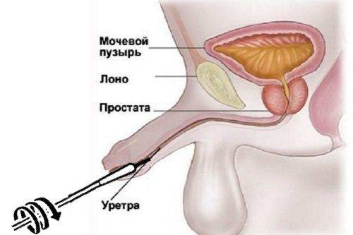 zabor-mazka-na-floru-u-muzhchin