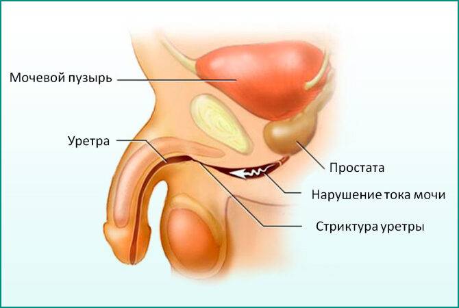 zhzhenie-posle-mocheispuskanija-u-muzhchin-5